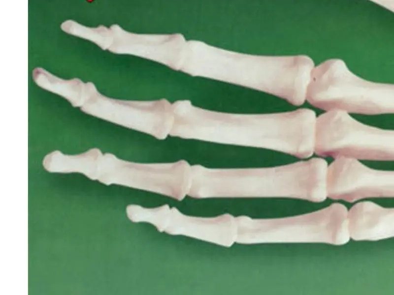 Zm71313 - Human Skeletal Hand Model Kit Lindberg Unassembled Life Size 2